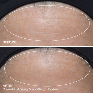 Before & After Using Smoothing Booster