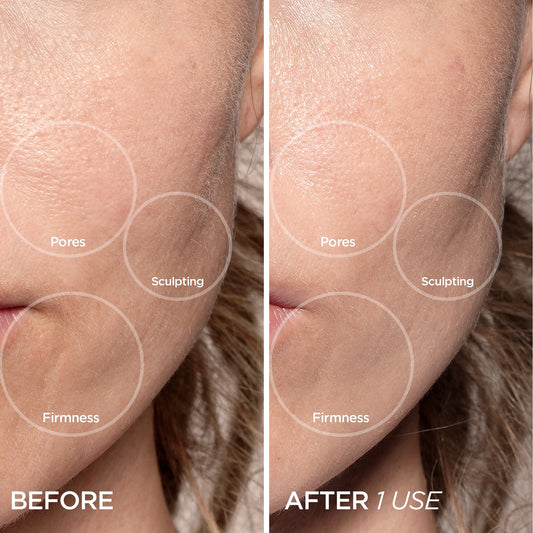 Cryo Roller Tools BeautyBio