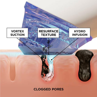 Golden Glow Hydration Facial