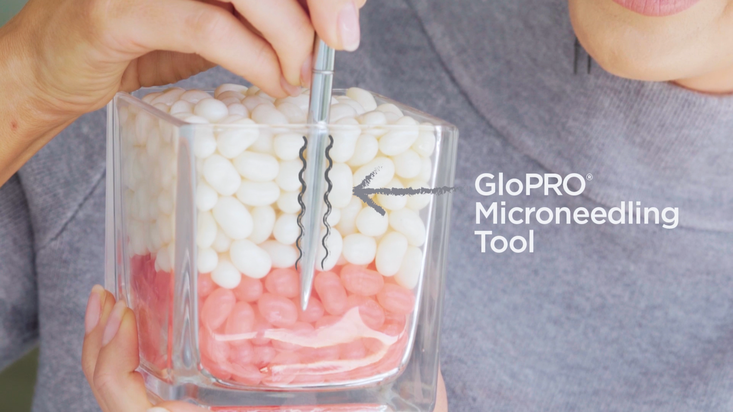 BeautyBio: Microneedling Explained
