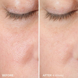 The Firmer Skin Duo Skincare BeautyBio