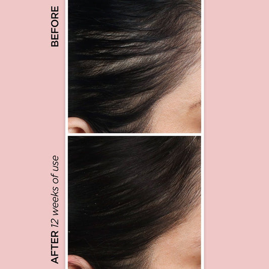 Rejuvenating Scalp + Fuller Hair Therapy Set Sets BeautyBio