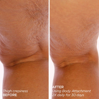 GloPRO® BODY MicroTip™