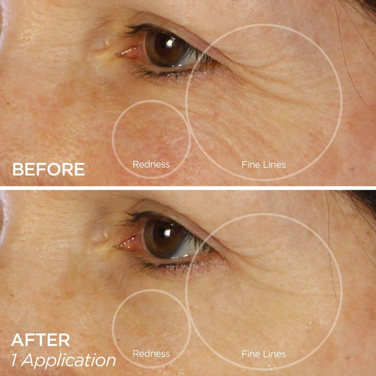 Before & After Using Bright Eye Gels