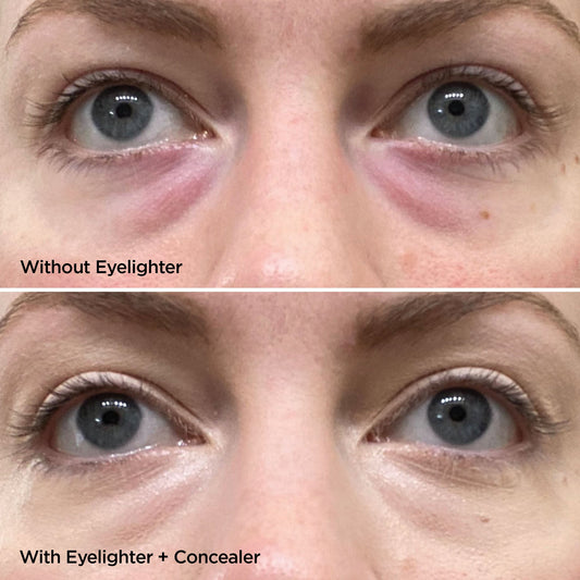 The Eyelighter Concentrate Skincare BeautyBio