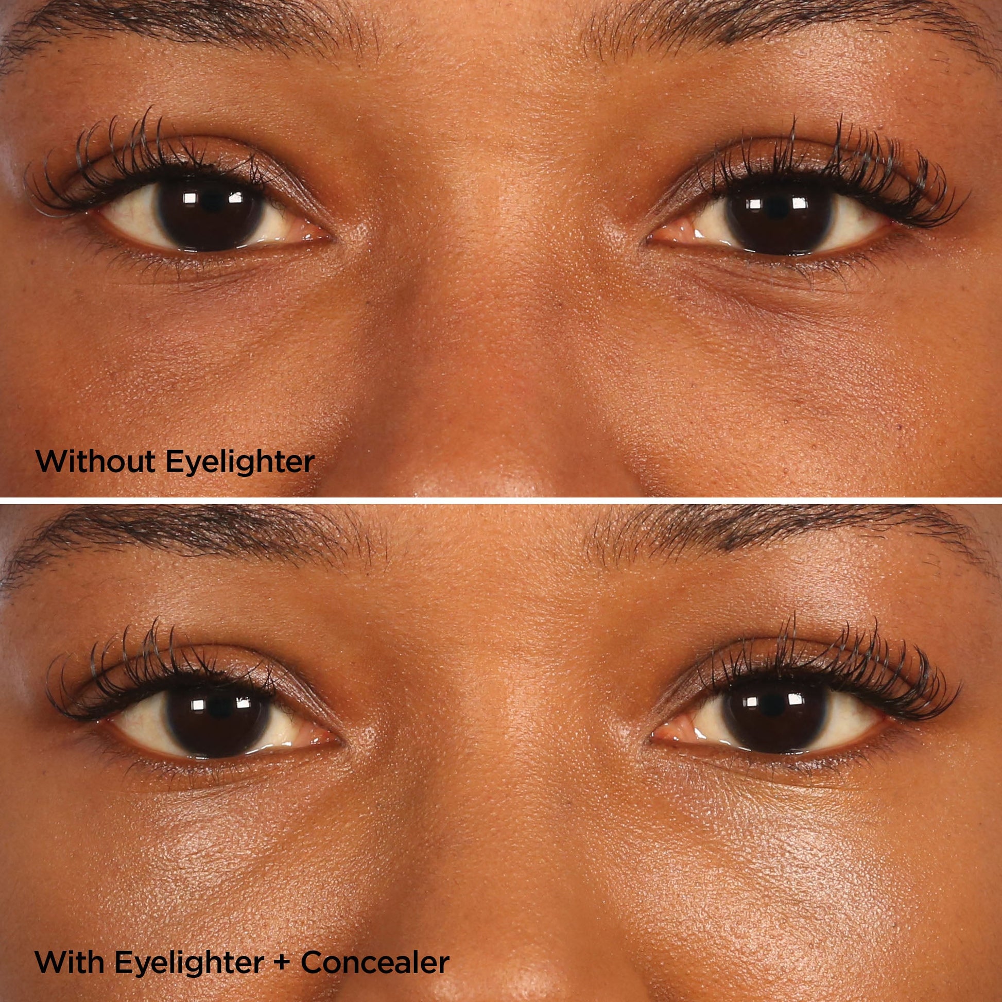 The Eyelighter Concentrate Skincare BeautyBio 