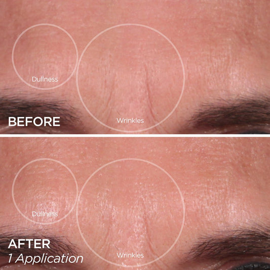 The Quench | Fills in Lines & Wrinkles | BeautyBio