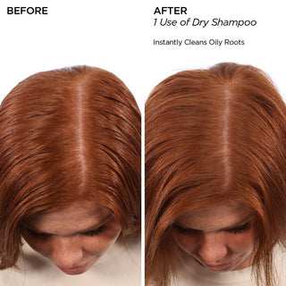 Healthy Scalp Dry Shampoo Haircare BeautyBio