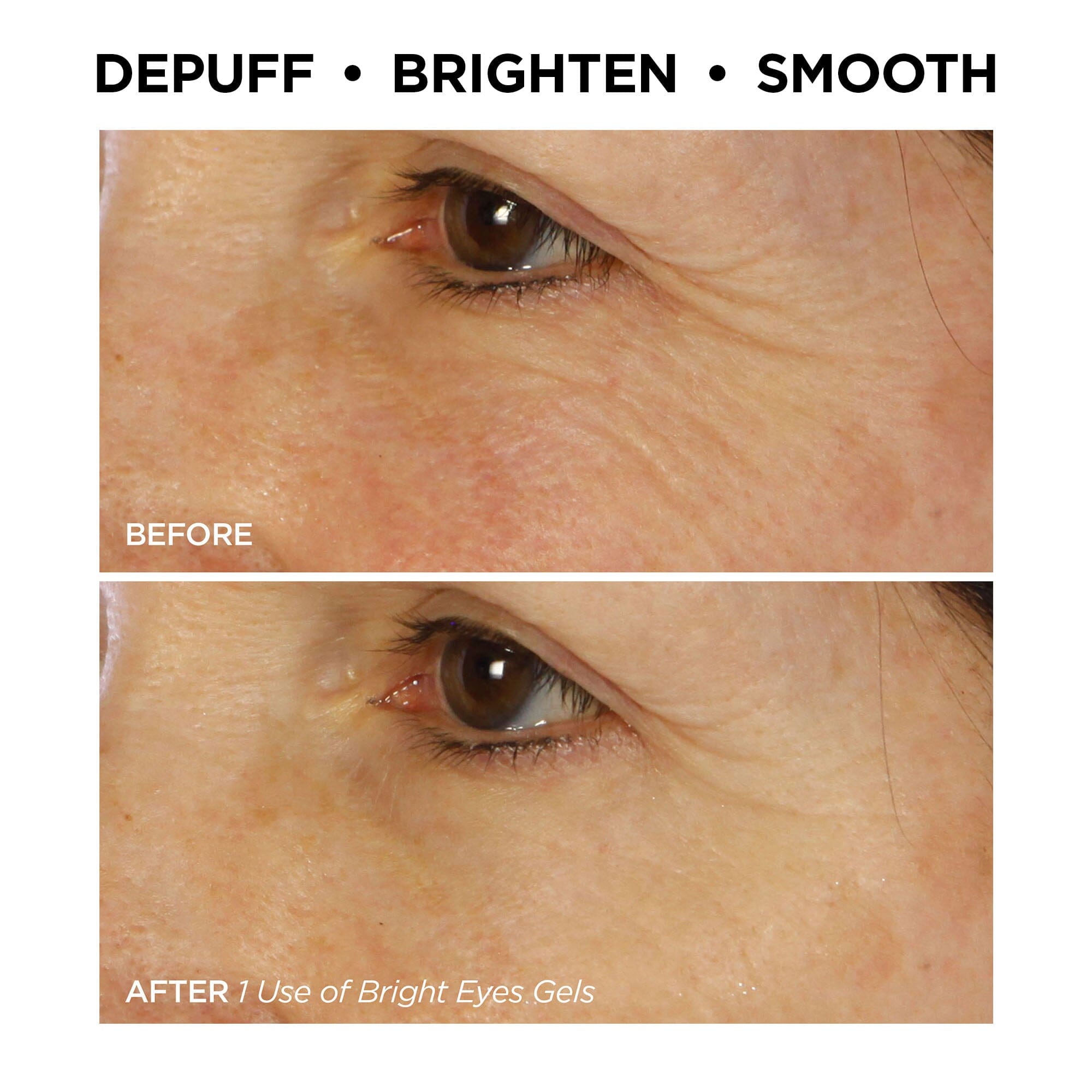 BeautyBio Bright Eyes Collagen Patches Under Eye Gels