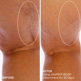 Sculpt & Smooth Body Bundle