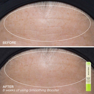 Skin Booster Mix & Match