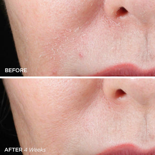 Morning & Night Skincare Routine