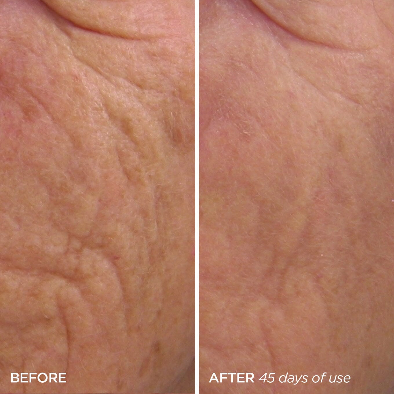 R45 Retinol Treatment + Quench Barrier Cream Skincare BeautyBio 