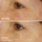 Before & After Using Bright Eye Gels