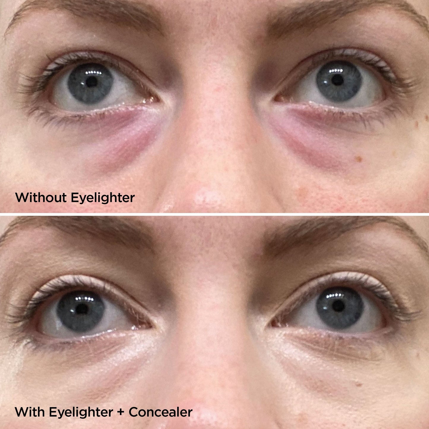 The Eyelighter Concentrate Skincare BeautyBio 