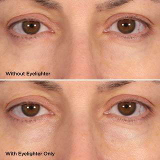 The Eyelighter Concentrate