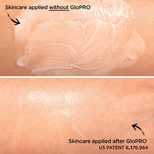 GloPRO® Facial Microneedling Tool GloPRO BeautyBio 