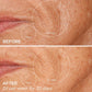 Chrome GloPRO® Microneedling Facial Regeneration Tool GloPRO BeautyBio 