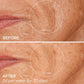 Before and After | BeautyBio GloPRO® Microneedling Tool for Younger-Looking Skin