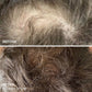 Men's Scalp & Beard hair loss treatment Helps Thinning Hair and Bald Spots