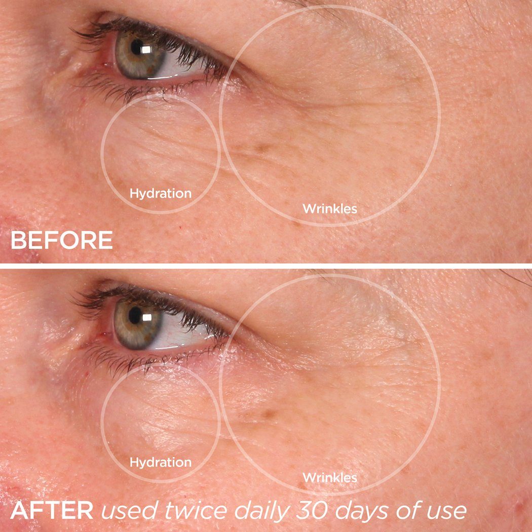 The Quench | Eye Balm Skincare BeautyBio 
