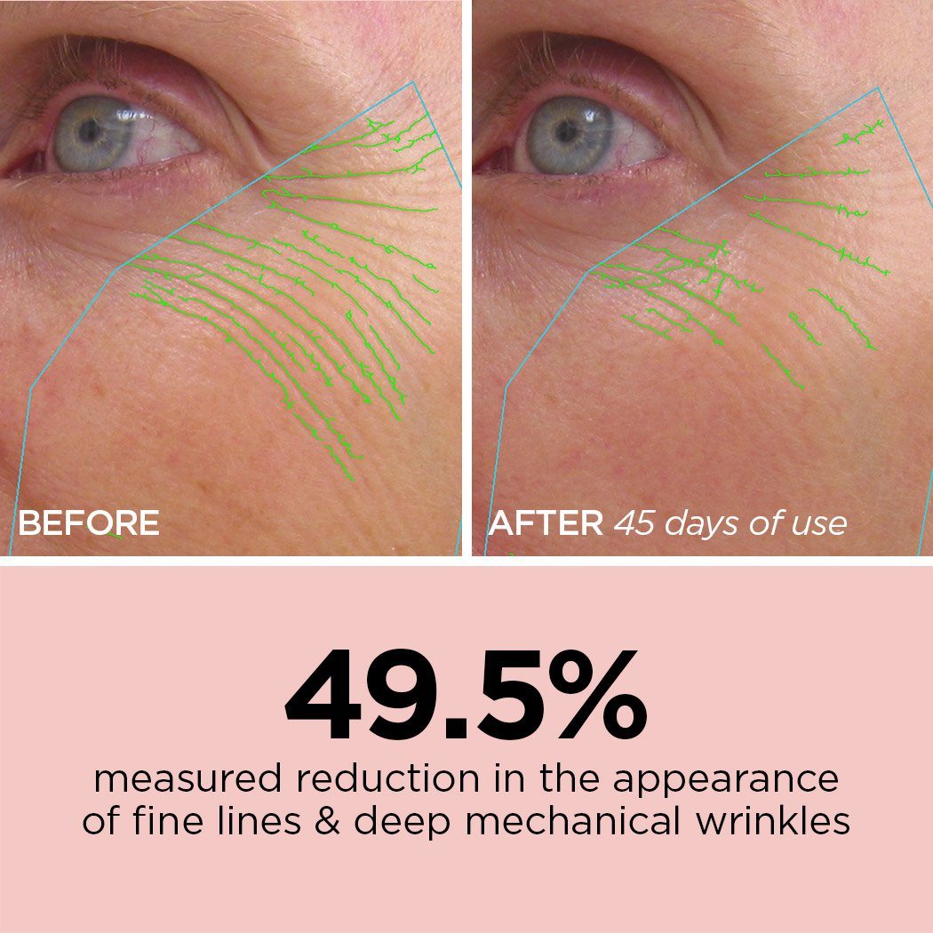 R45 | Retinol | Reduces Wrinkles and Fine Lines | Before & After | BeautyBio