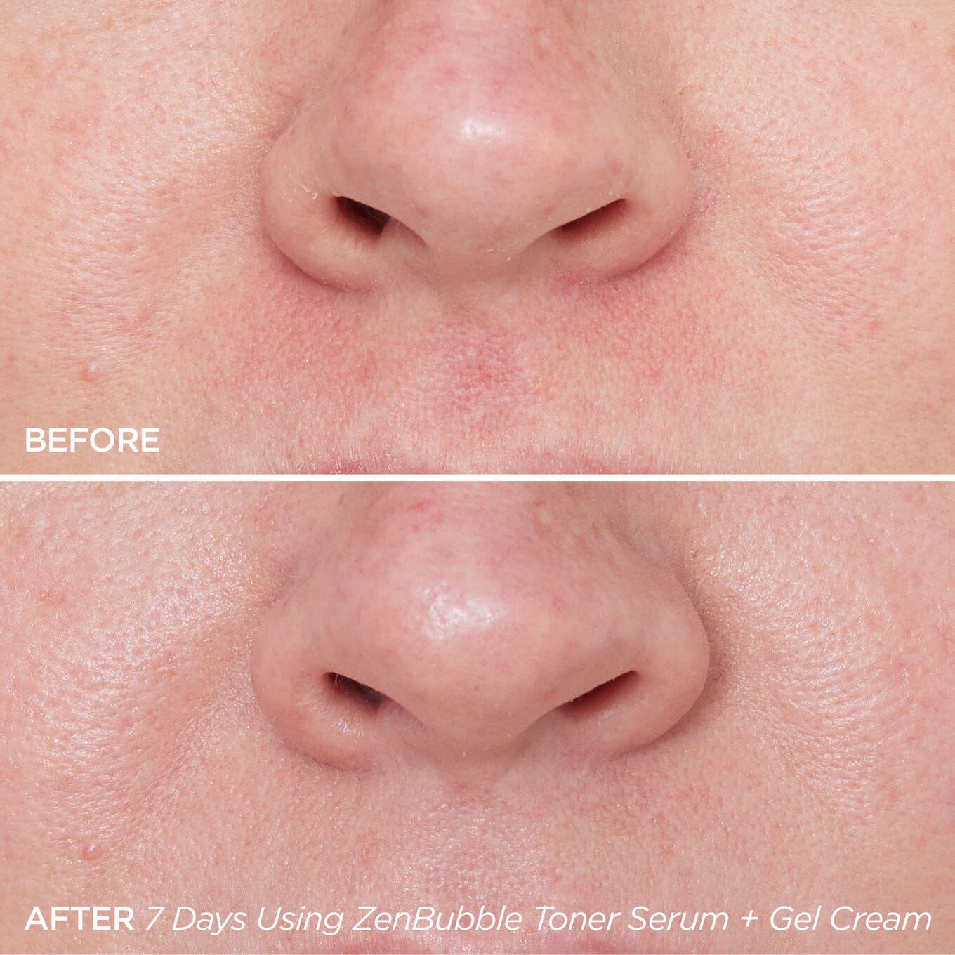 ZenBubble Bi-Phase Serum | Oil Control Toner | BeautyBio